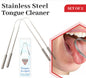 2x Stainless Steel Tongue Cleaner Dental Care Hygiene Oral Mouth Scraper